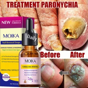 Fungal Nail Treatment Serum